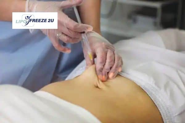 How Does Aqualyx Fat Dissolving Injection Work to Break Down Fat Reigate?