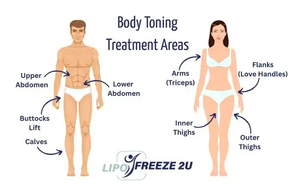 Graphic showing where you can have Body toning Treatment Reigate on your body